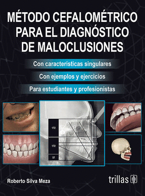 METODO CEFALOMETRICO PARA EL DIAGNOSTICO DE MALOCLUSIONES