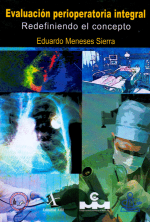 EVALUACION PERIOPERATORIA INTEGRAL