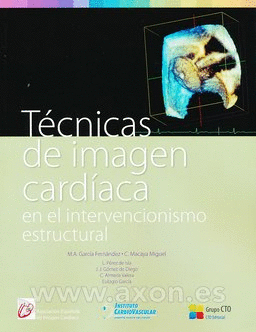 TECNICAS DE IMAGEN CARDIACA EN EL INTERVENCIONISMO ESTRUCTURAL