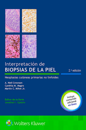 INTERPRETACION DE LA BIOPSIA DE LA PIEL