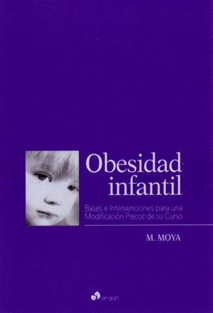 OBESIDAD INFANTIL