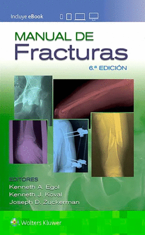 MANUAL DE FRACTURAS