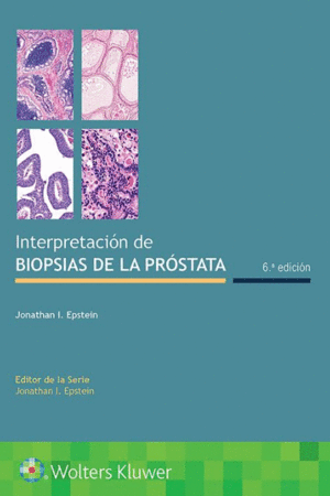 INTERPRETACION DE BIOPSIAS DE LA PROSTATA