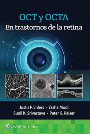 OCT Y OCTA EN TRASTORNOS DE LA RETINA