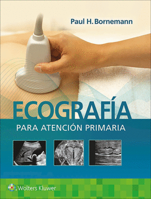 ECOGRAFIA PARA ATENCION PRIMARIA