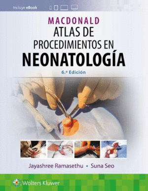 MACDONALD ATLAS DE PROCEDIMIENTOS EN NEONATOLOGIA