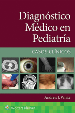 DIAGNOSTICO MEDICO EN PEDIATRIA