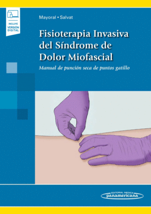 FISIOTERAPIA INVASIVA DEL SINDROME DE DOLOR MIOFASCIAL