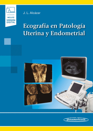 ECOGRAFIA EN PATOLOGIA UTERINA Y ENDOMITRAL