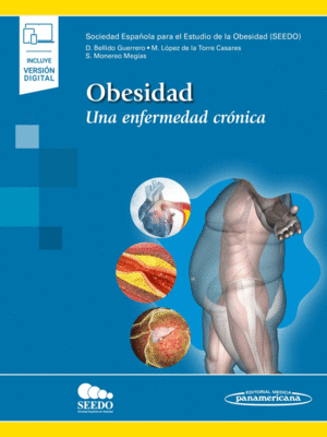 OBESIDAD