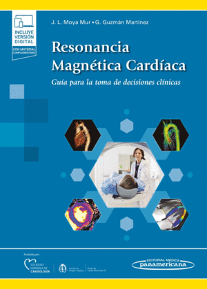 RESONANCIA MAGNETICA CARDIACA