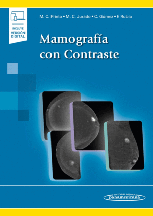 MAMOGRAFIA EN CONTRASTE