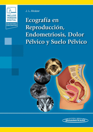 ECOGRAFIA EN REPRODUCCION ENDOMETRIOSIS DOLOR PELVICO Y SUELO PELVICO