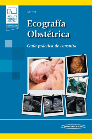 ECOGRAFIA OBSTETRICA