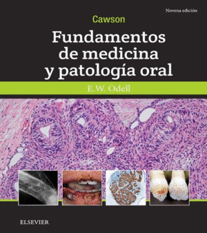 CAWSON FUNDAMENTOS DE MEDICINA Y PATOLOGIA ORAL