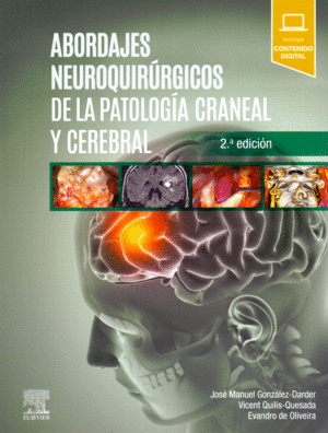 ABORDAJES NEUROQUIRURGICOS DE LA PATOLOGIA CRANEAL Y CEREBRAL