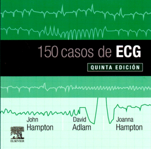 150 CASOS DE ECG