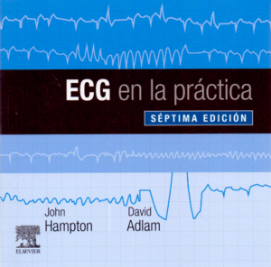 ECG EN LA PRACTICA