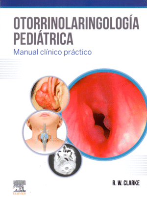 OTORRINOLARINGOLOGIA PEDIATRICA