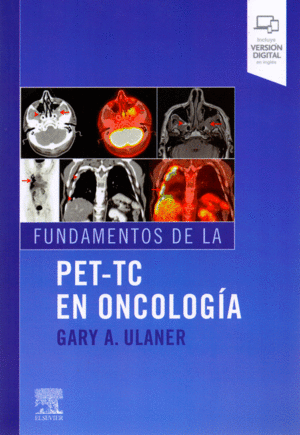 FUNDAMENTOS DE LA PET TC EN ONCOLOGIA