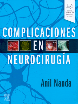 COMPLICACIONES EN NEUROCIRUGIA