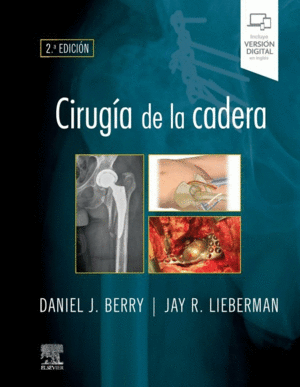 CIRUGIA DE LA CADERA
