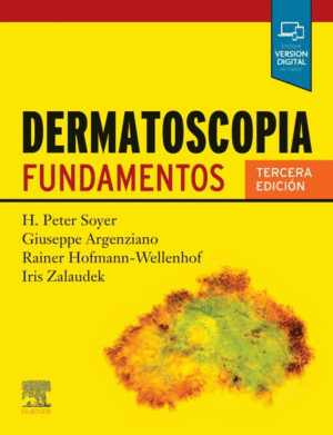 DERMATOSCOPIA FUNDAMENTOS
