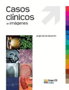 CASOS CLINICOS EN IMAGENES