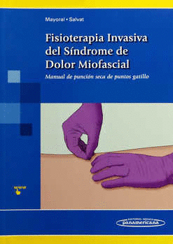 FISIOTERAPIA INVASIVA DEL SINDROME DE DOLOR MIOFASCIAL