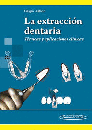 EXTRACCION DENTARIA