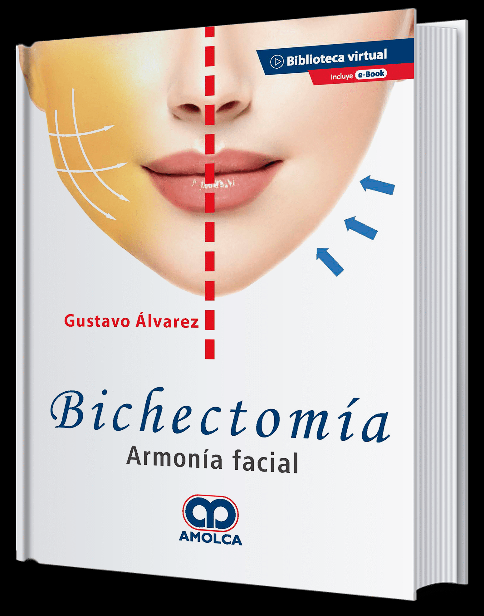 BICHECTOMIA