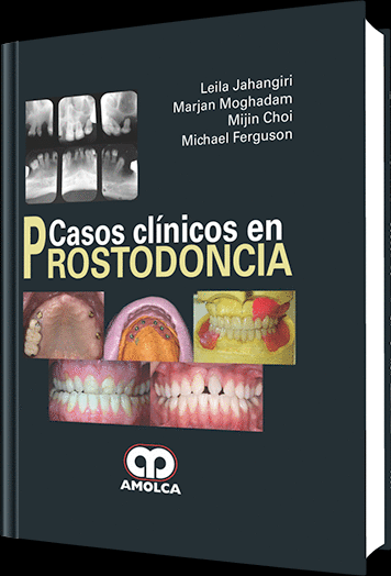 CASOS CLINICOS EN PROSTODONCIA