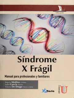 SINDROME X FRAGIL
