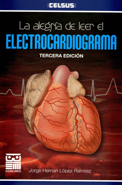 ALEGRIA DE LEER EL ELECTROCARDIOGRAMA LA